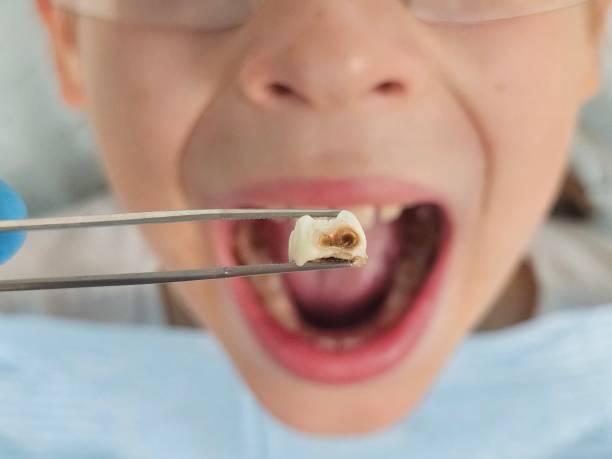 Best Emergency TMJ Treatment in Dewitt, IA